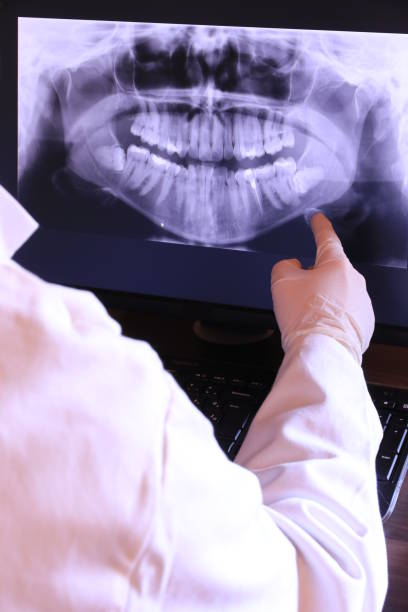 Best Emergency Dentist for Knocked-Out Tooth in Pana, IL